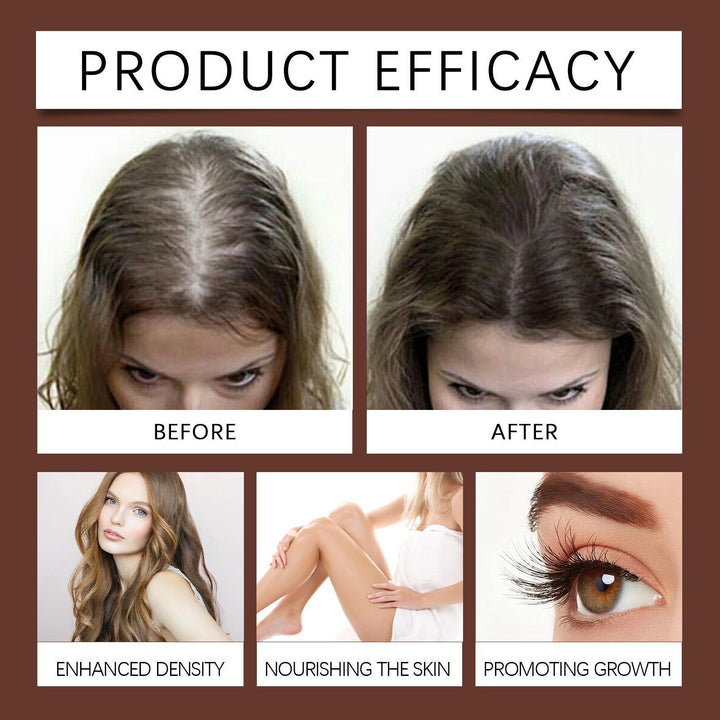 Xiyue All in One Castor Oil for Skin Eyelashes and Eyebrows